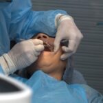 Orthodontie pour adultes
